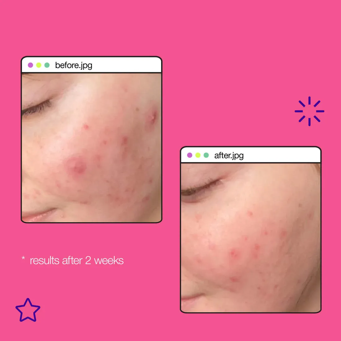 Dermalogica Clear Start Breakout Clearing Liquid Peel