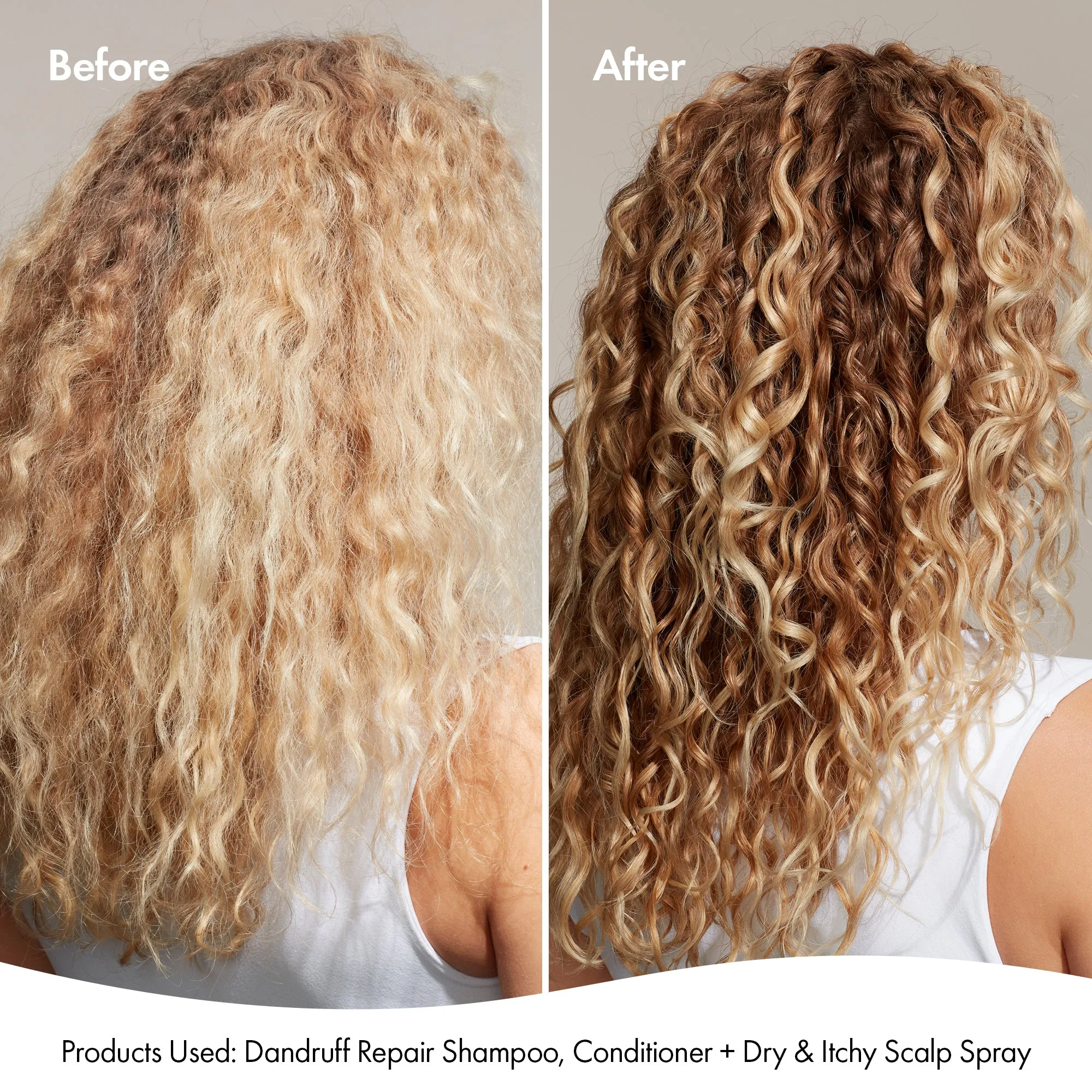 DRY   ITCHY SCALP SPRAY
