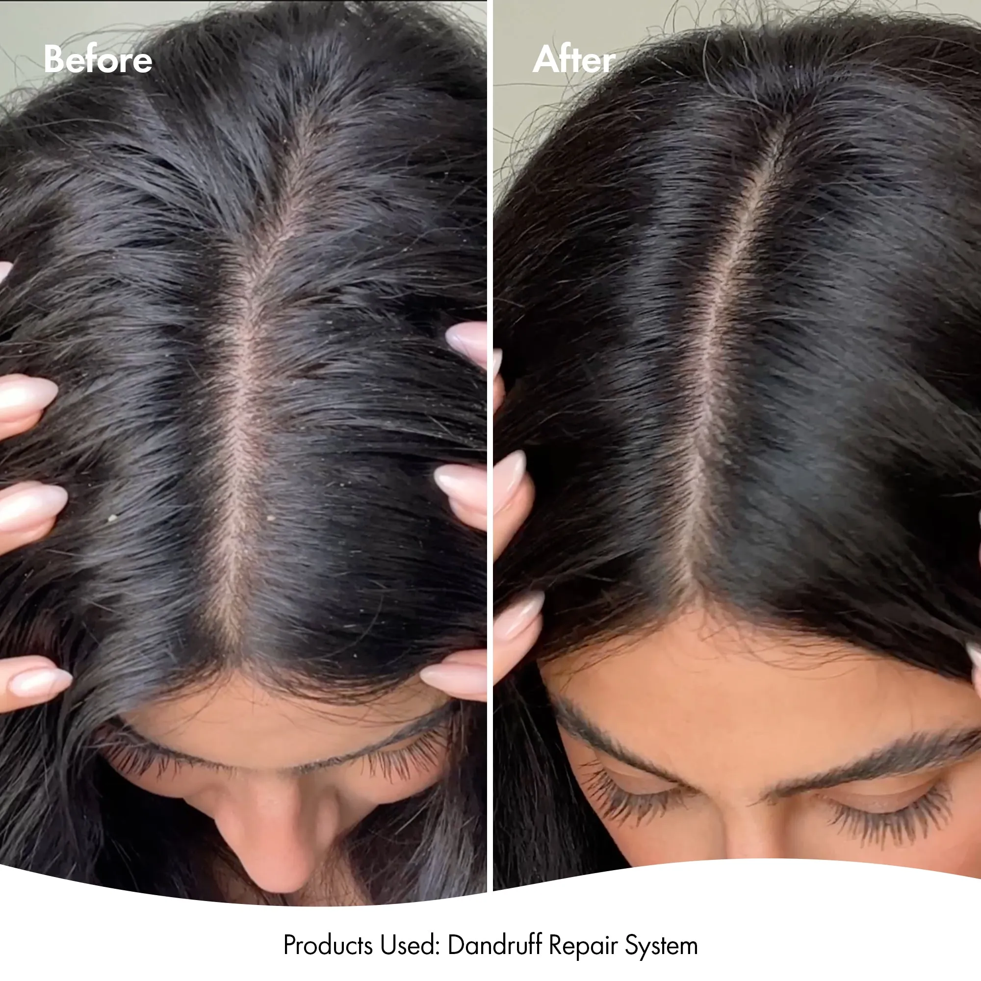 DRY   ITCHY SCALP SPRAY