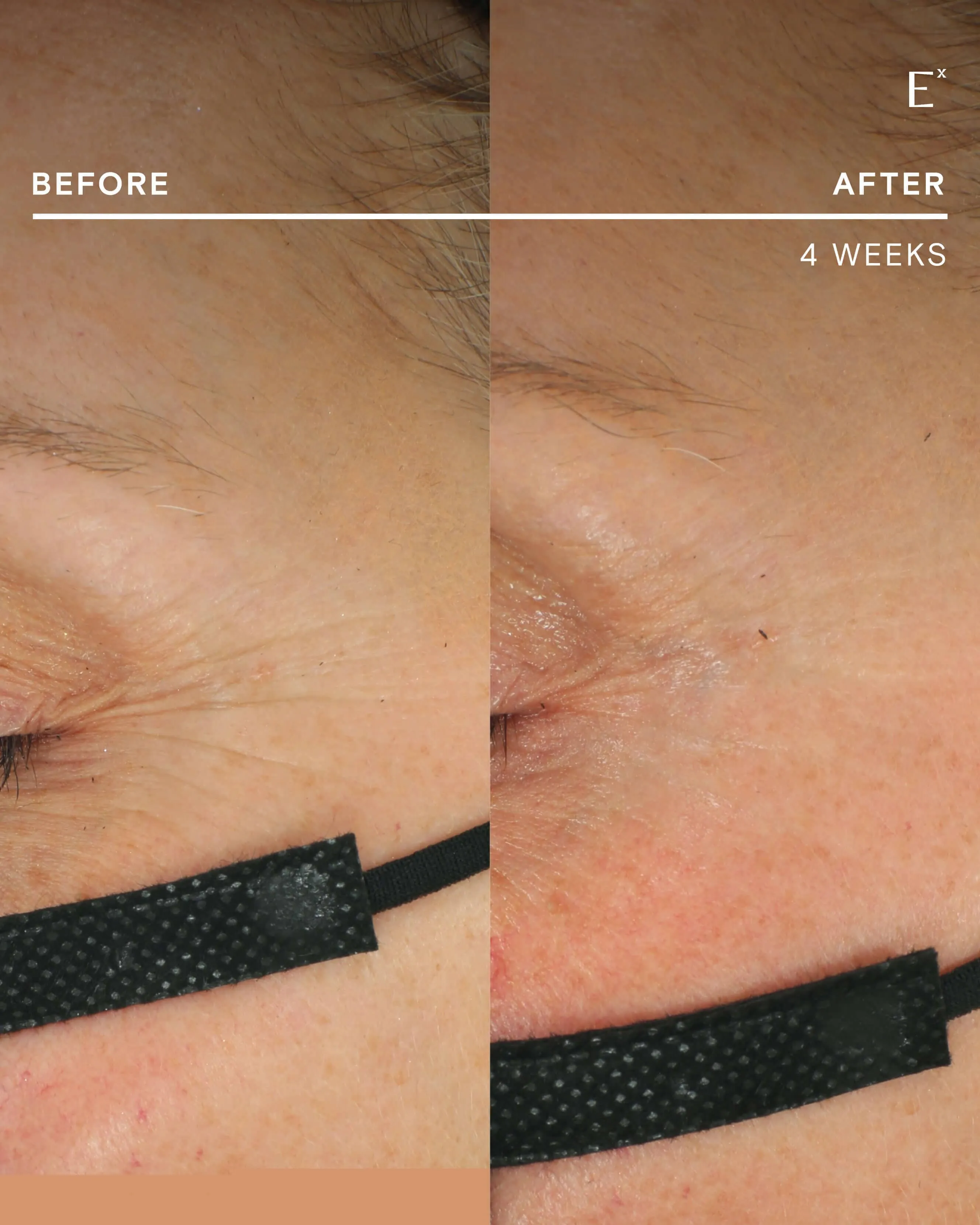 Firming Filter CoQ10 Antioxidant Power Serum & Refill