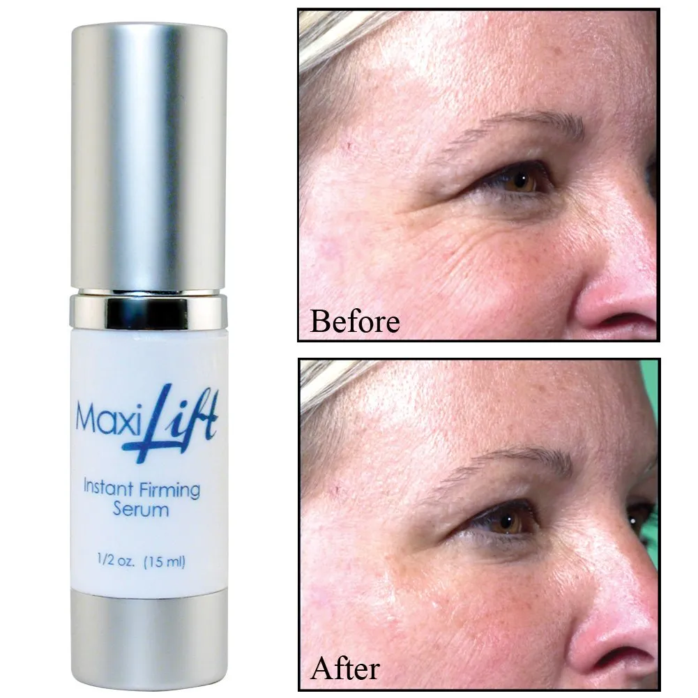 Maxilift Instant Firming Serum by BioLogic Solutions, 0.5 oz.